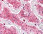 COMT Antibody (Internal)